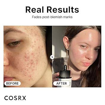 COSRX The Niacinamide 15 Serum - Image 6