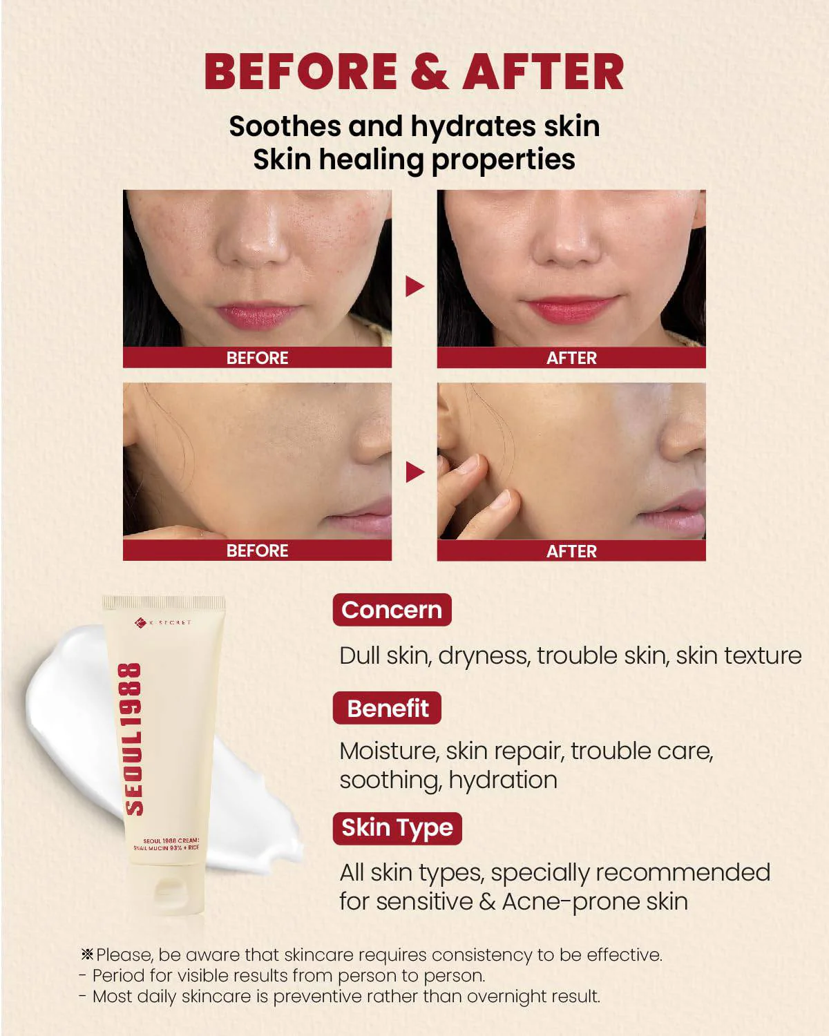 KSECRET Seoul 1988 CREAM: Snail Mucin 93% + Rice 100mL - Image 5