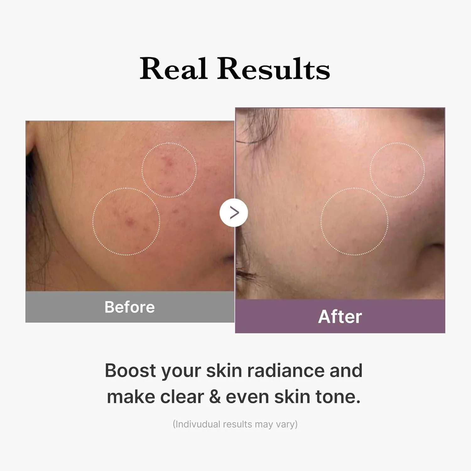MEDICUBE Age-R Glutathione Glow Toner 140mL - Image 6