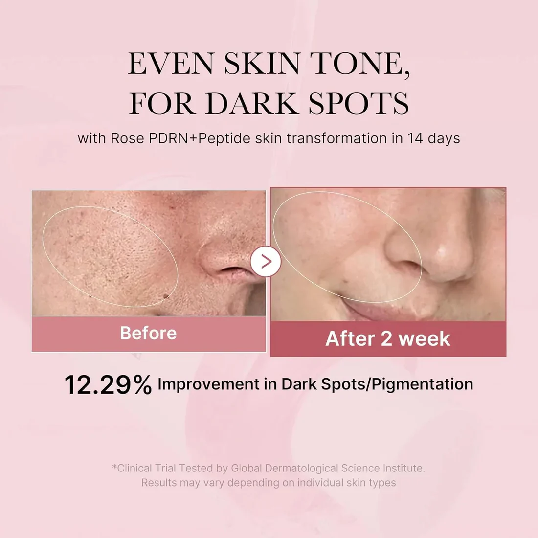 MEDICUBE PDRN Pink Niacinamide Milky Toner 150mL - Image 6
