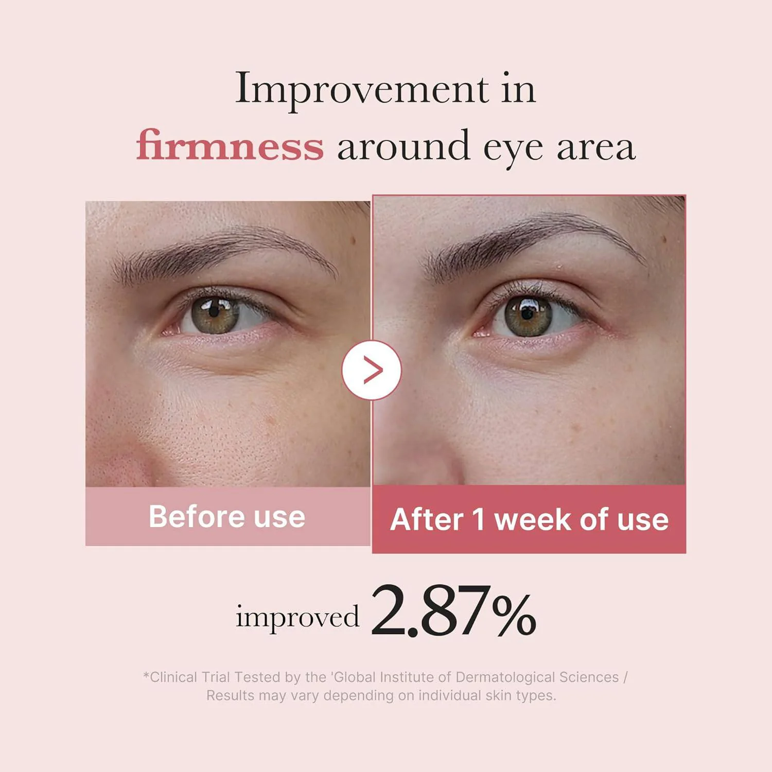 MEDICUBE PDRN Pink Peptide Eye Cream 30mL - Image 4