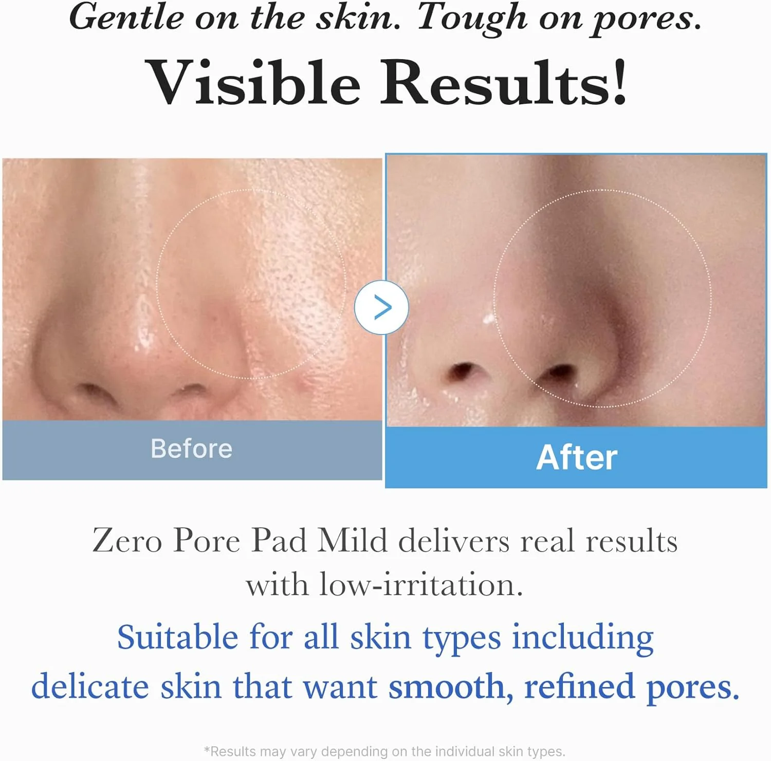 MEDICUBE Zero Pore Pad Mild (70pcs) - Image 7