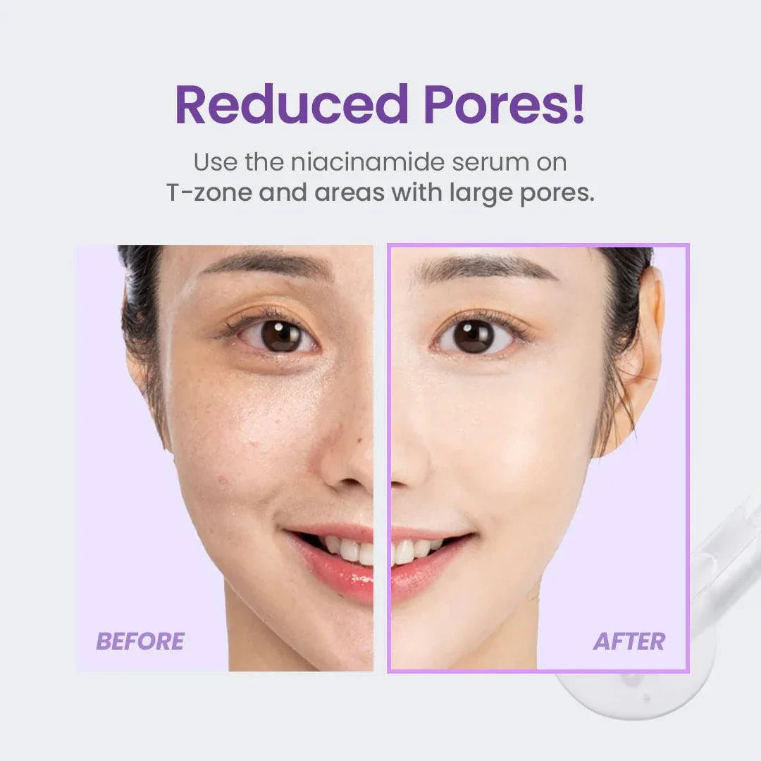 TIRTIR Niacinamide 20% Serum 30mL - Image 7