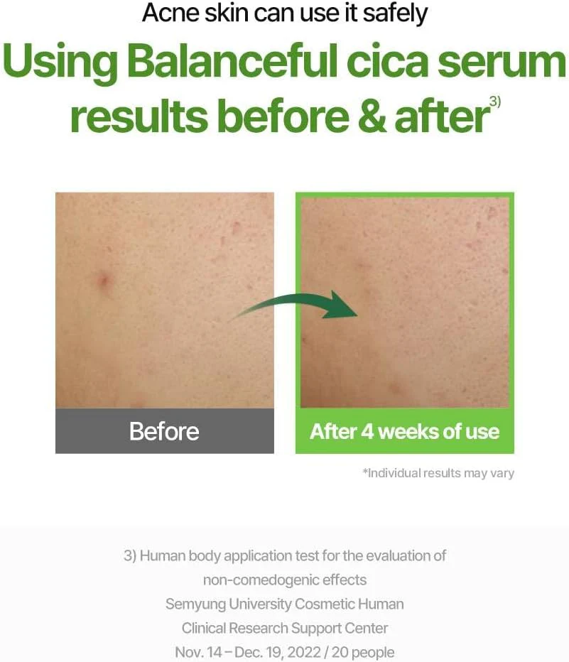 TORRIDEN Balanceful Cica Serum 50mL - Image 12