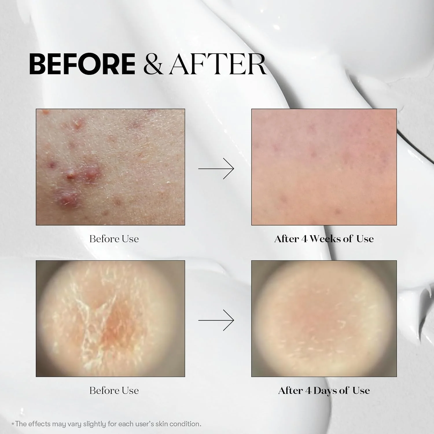 VT COSMETICS Collagen Pink Reedle Shot 300 - Image 6